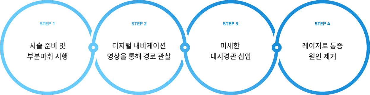 STEP1 - 시술 준비 및 부분마취 시행, STEP2 - 디지털 내비게이션 영상을 통해 경로 관찰, STEP3 - 미세한 내시경관 삽입, STEP4 - 레이저로 통증 원인 제거